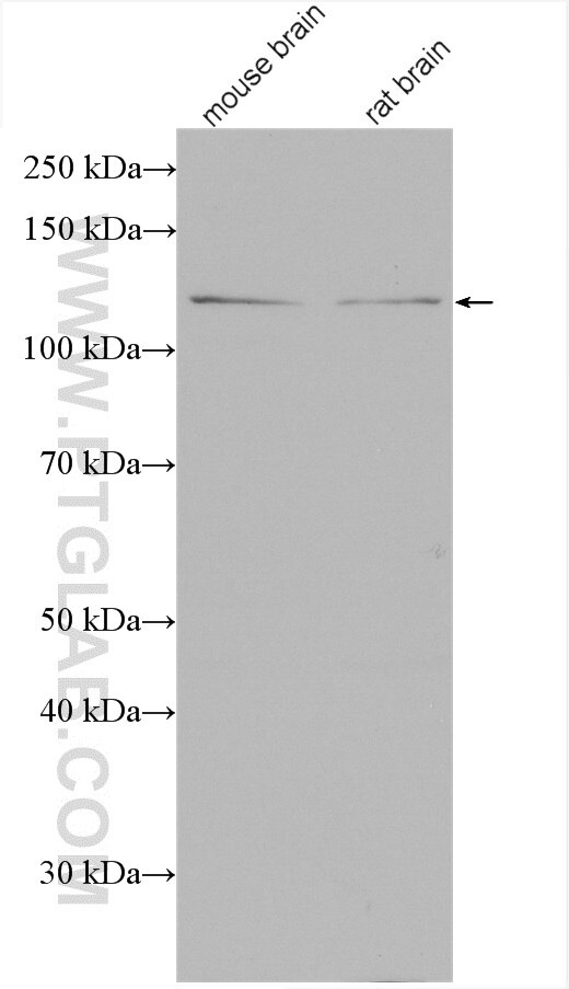 Western Blot (WB) analysis of various lysates using Syndetin/CCDC132 Polyclonal antibody (27749-1-AP)