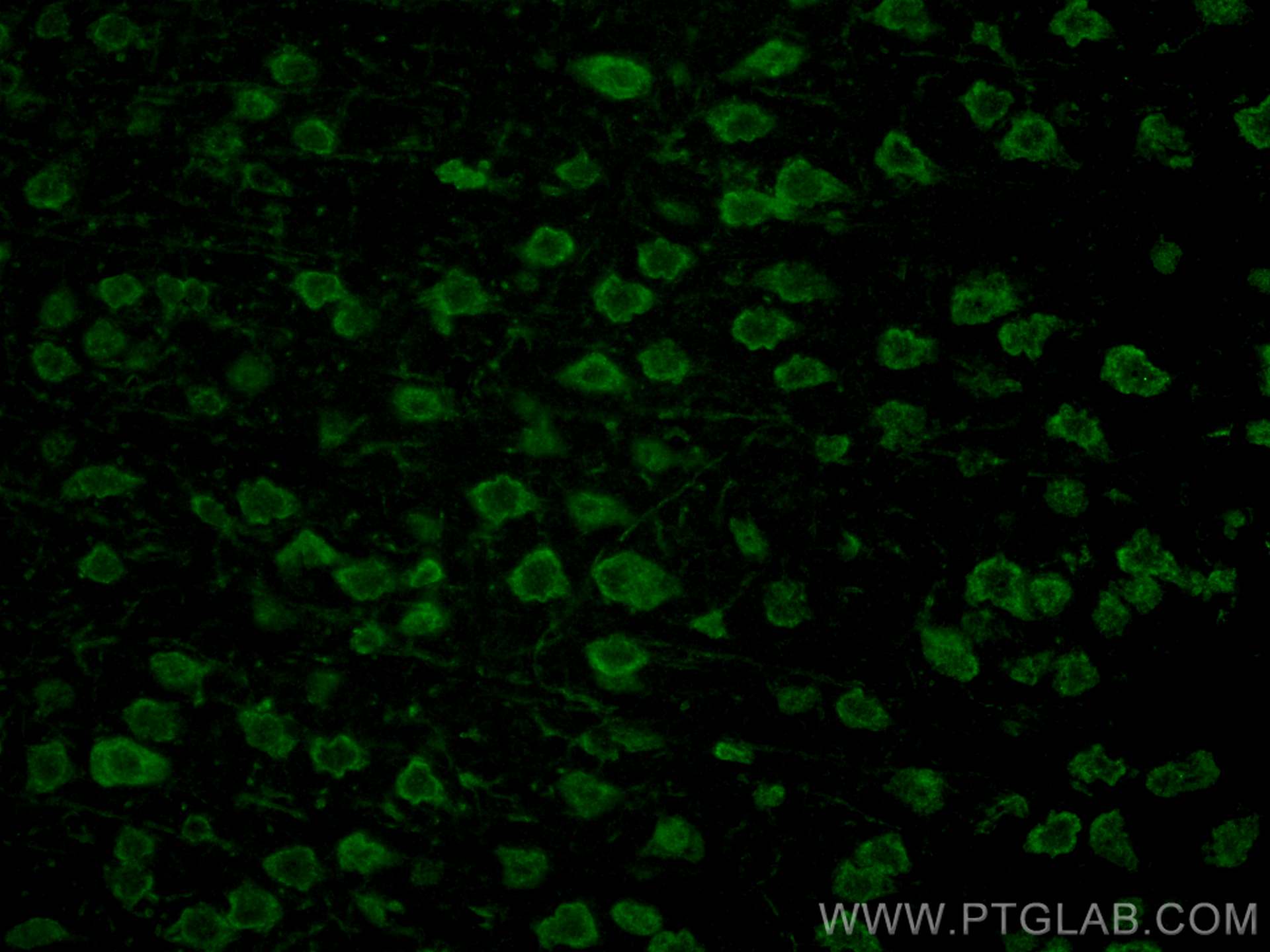 IF Staining of rat brain using CL488-16972