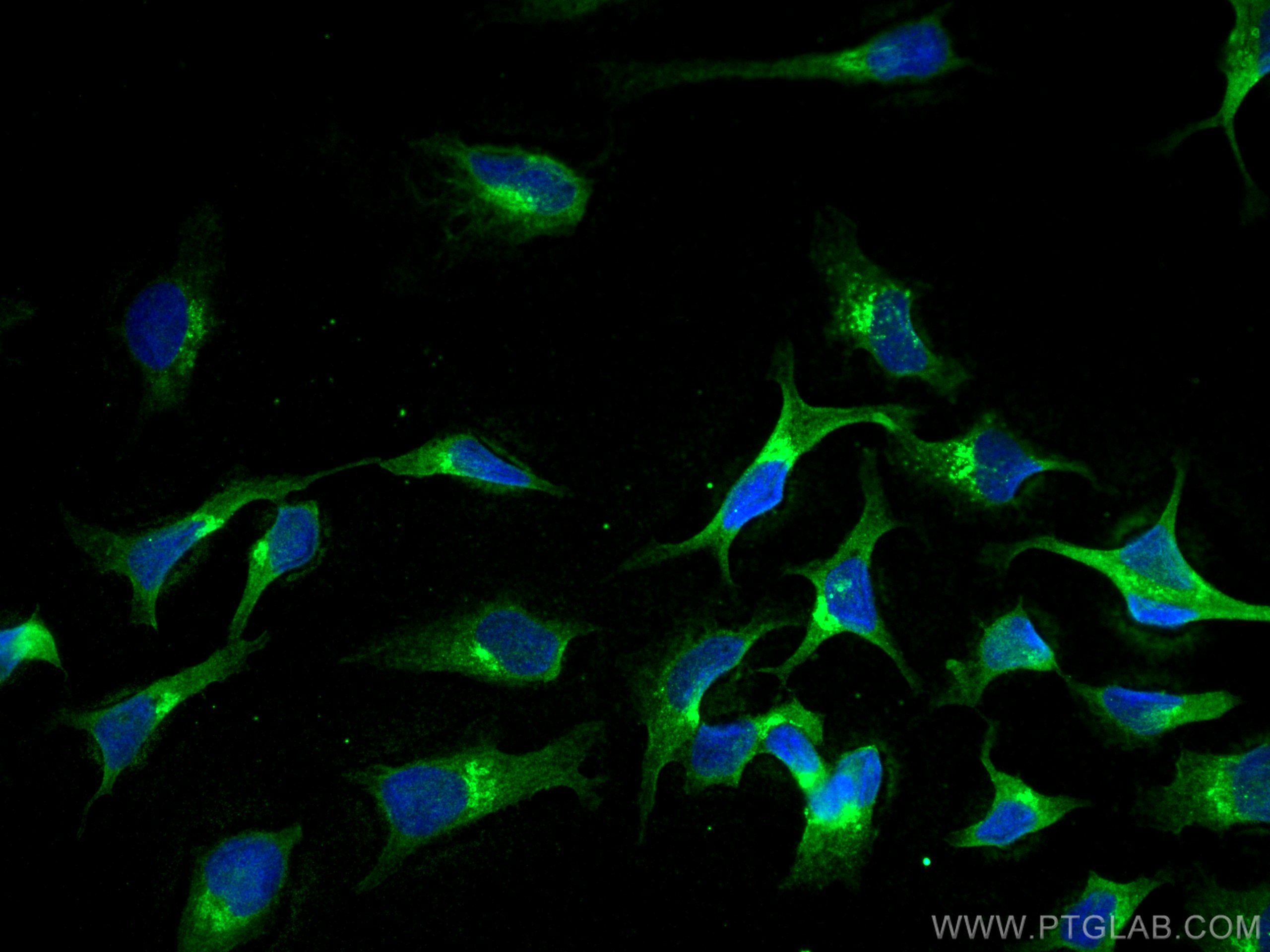 Immunofluorescence (IF) / fluorescent staining of HeLa cells using Syntaxin 10 Monoclonal antibody (66821-1-Ig)