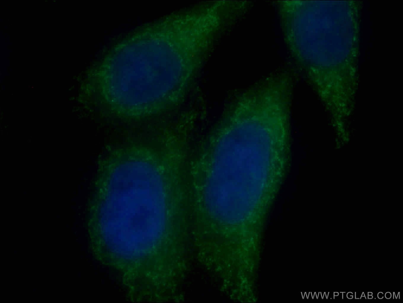 Immunofluorescence (IF) / fluorescent staining of HepG2 cells using Syntaxin 16 Monoclonal antibody (66775-1-Ig)