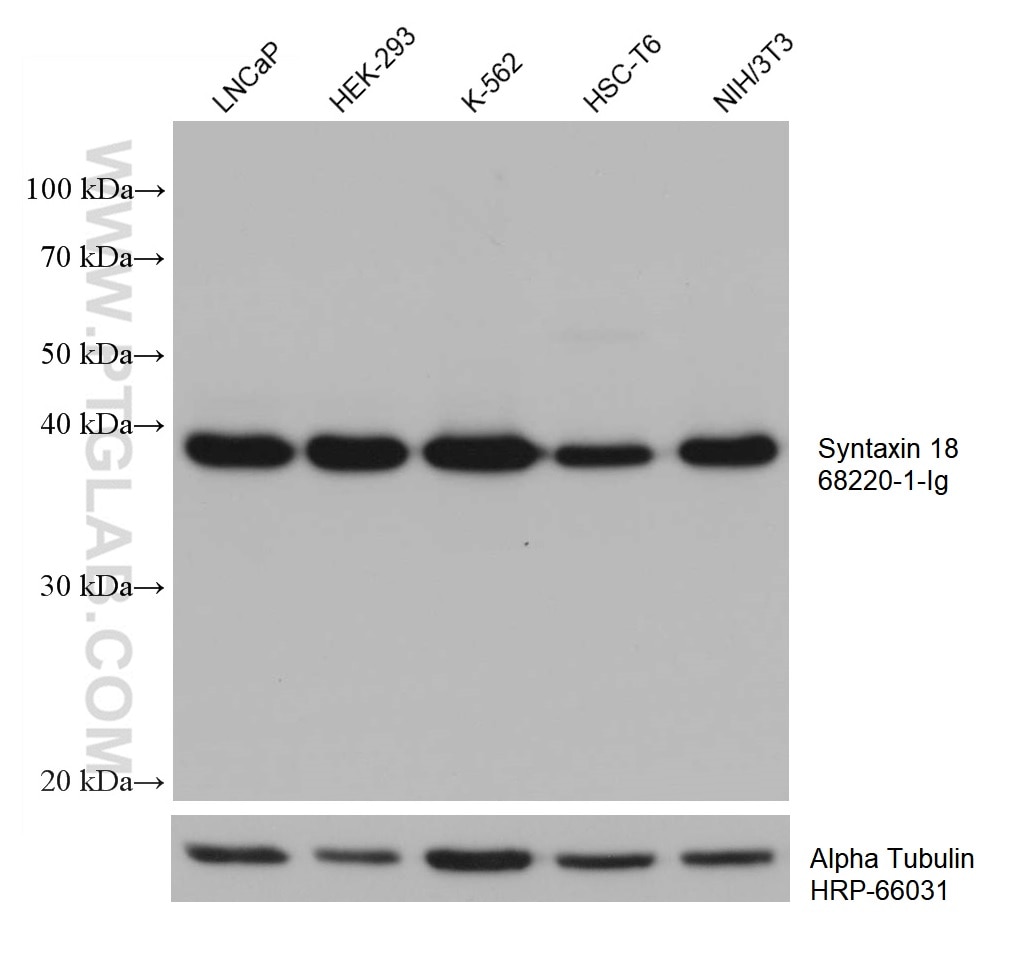 Western Blot (WB) analysis of various lysates using Syntaxin 18 Monoclonal antibody (68220-1-Ig)