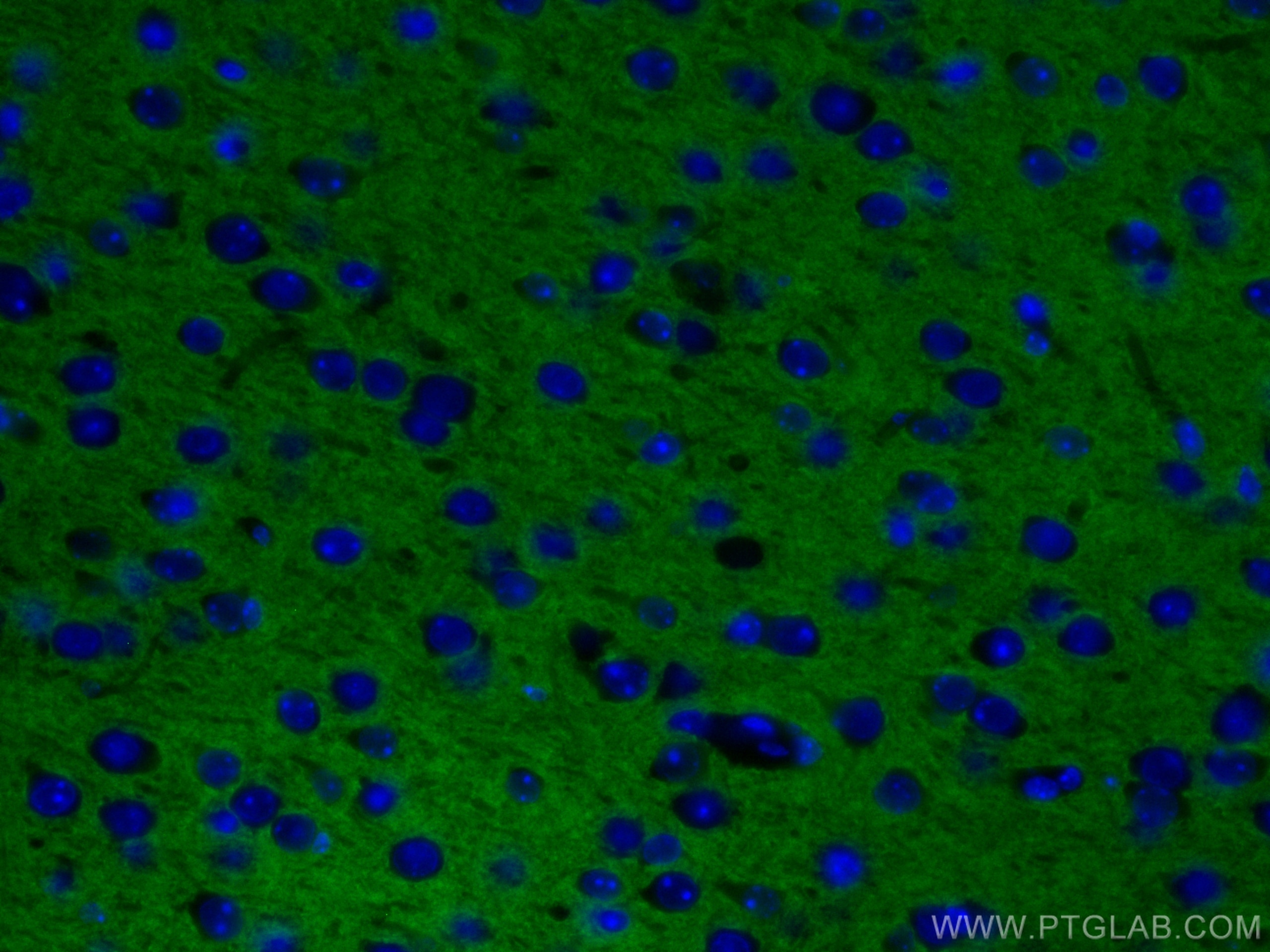 IF Staining of mouse brain using CL488-66437