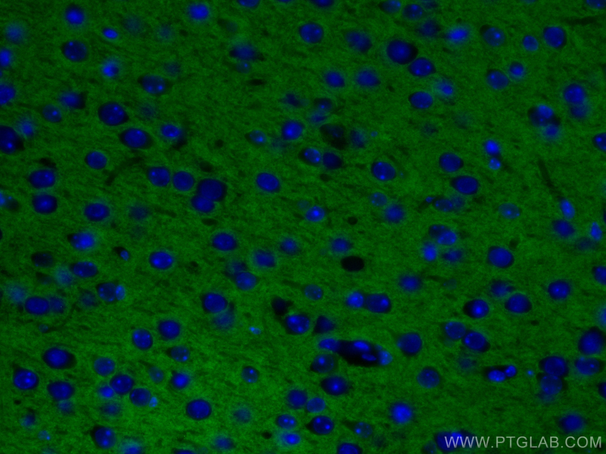 Immunofluorescence (IF) / fluorescent staining of mouse brain tissue using CoraLite® Plus 488-conjugated Syntaxin 1A / Syntax (CL488-66437)