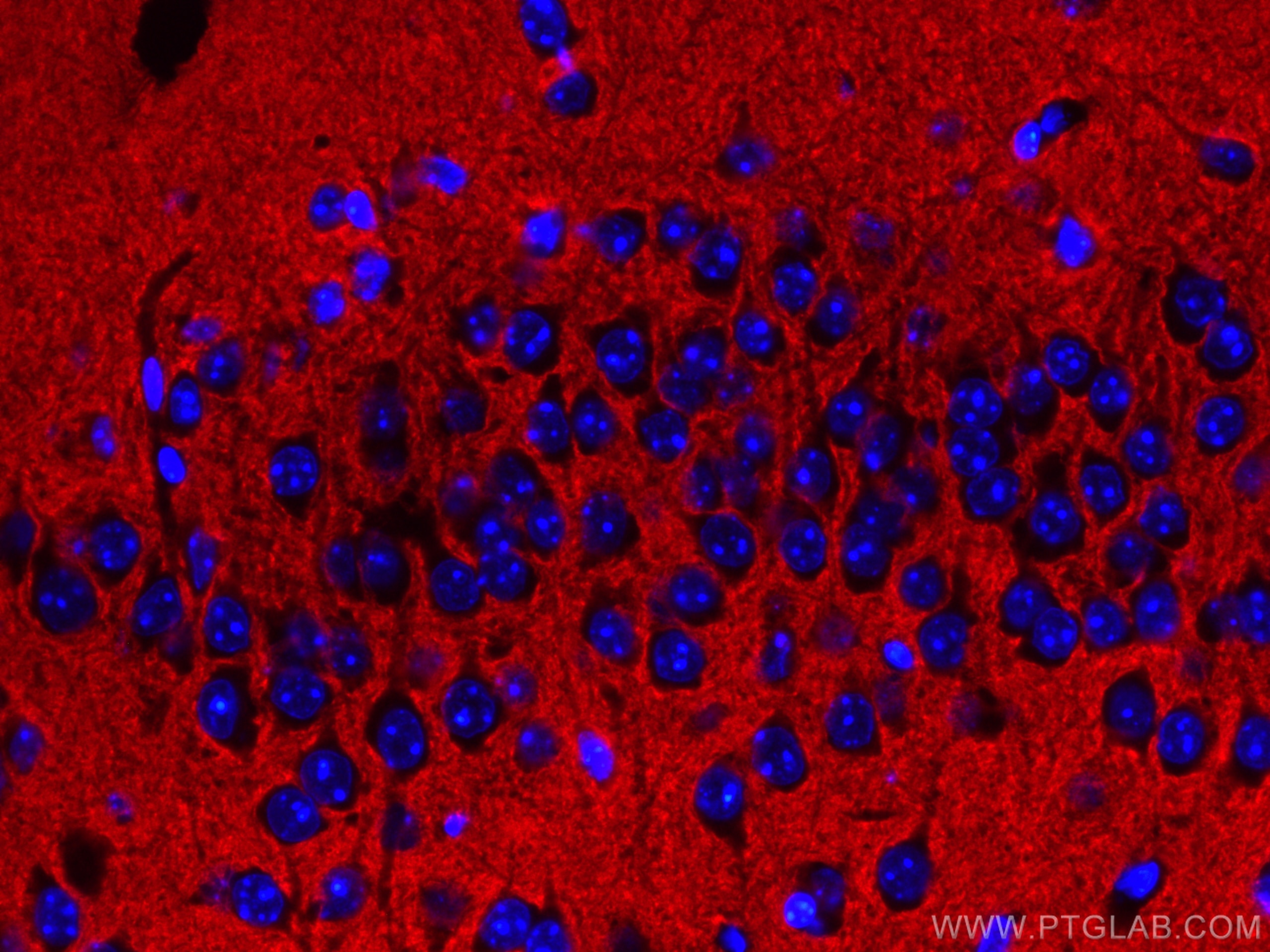 IF Staining of mouse brain using CL594-66437