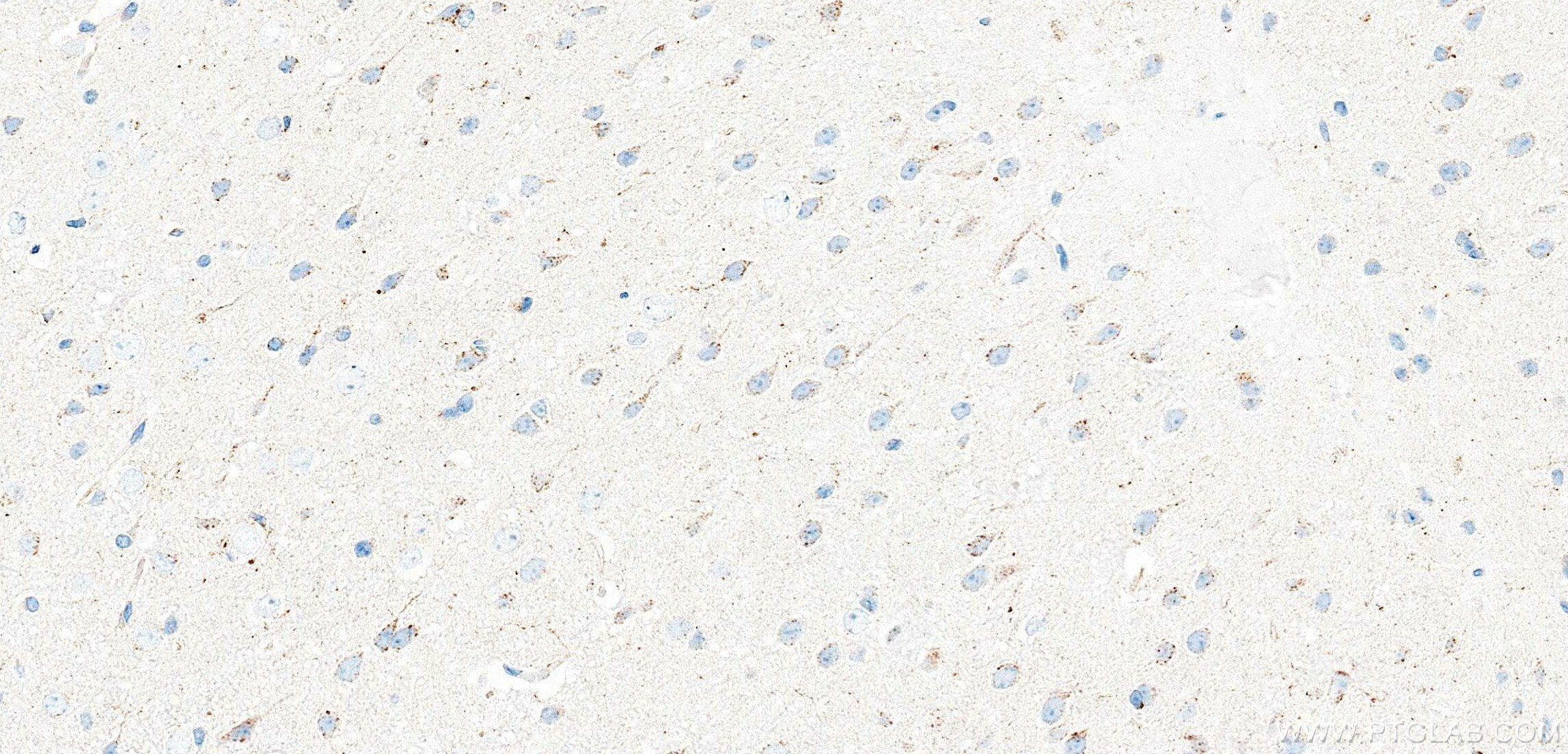 IHC staining of mouse brain using 87915-1-RR (same clone as 87915-1-PBS) Immunohistochemistry (IHC) staining of mouse brain tissue using Syntaxin 7 Recombinant monoclonal antibody (87915-1-RR)