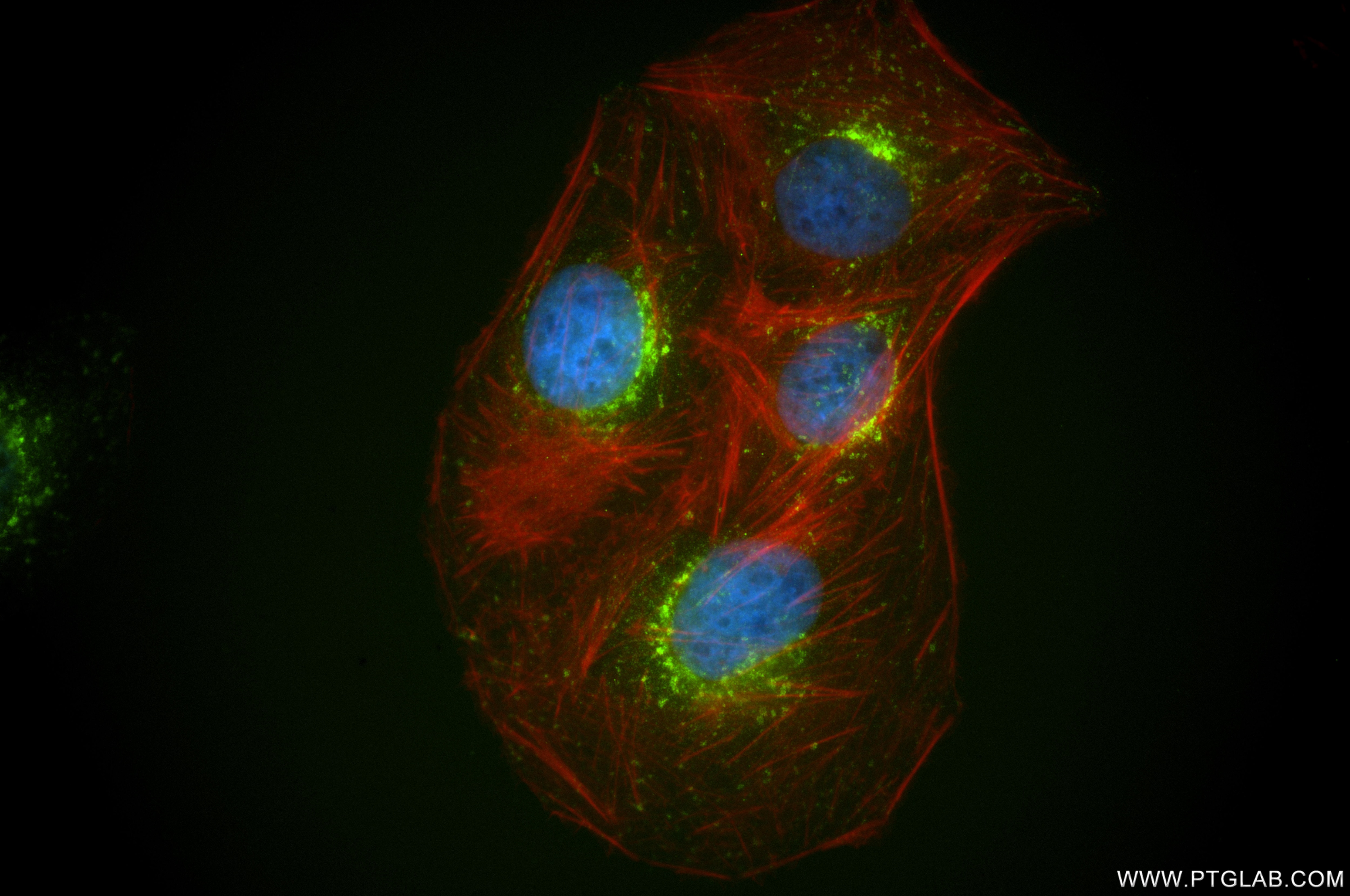 Immunofluorescence (IF) / fluorescent staining of U2OS cells using Syntaxin 8 Recombinant monoclonal antibody (86580-1-RR)