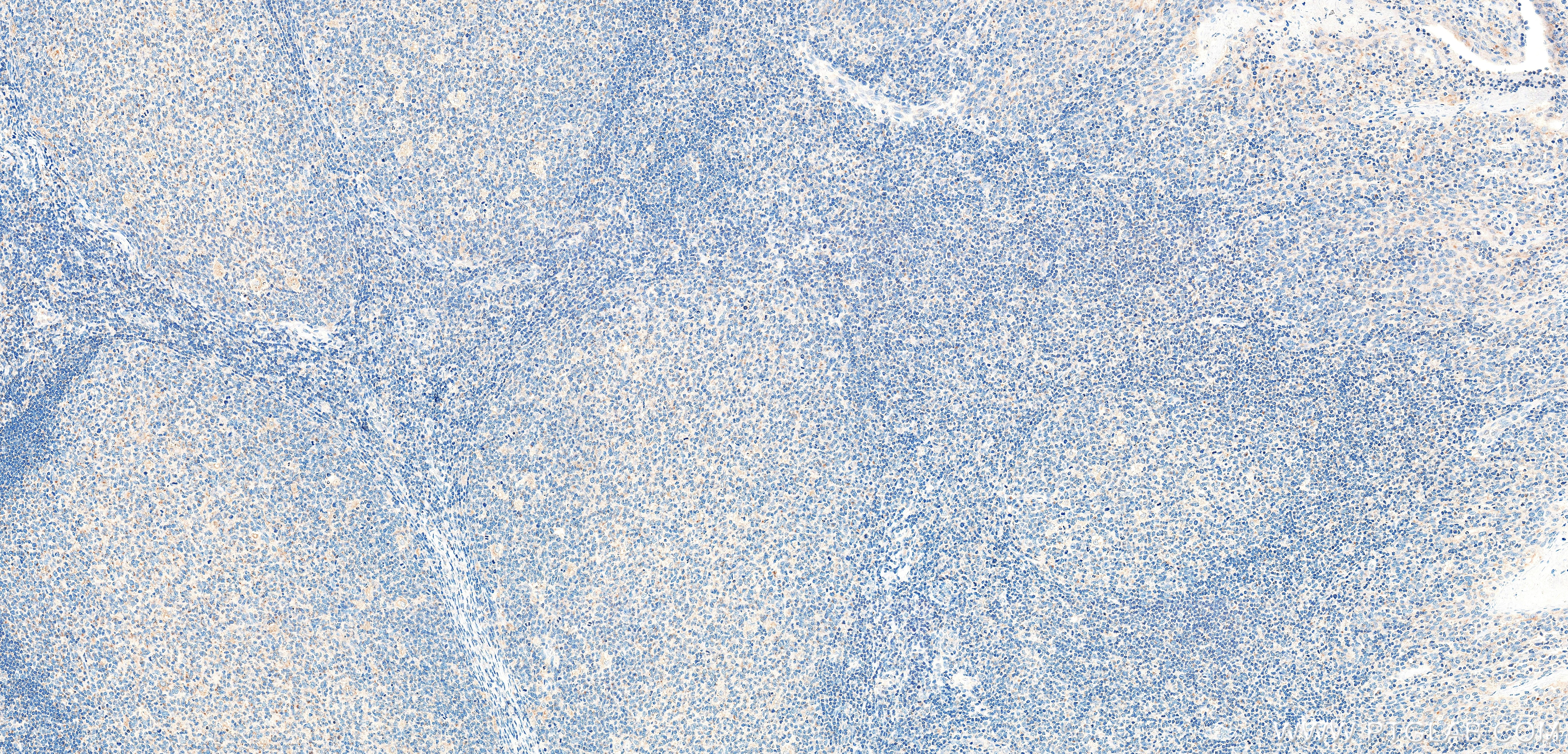 Immunohistochemistry (IHC) staining of human tonsil tissue using Syntaxin 8 Recombinant monoclonal antibody (86580-1-RR)