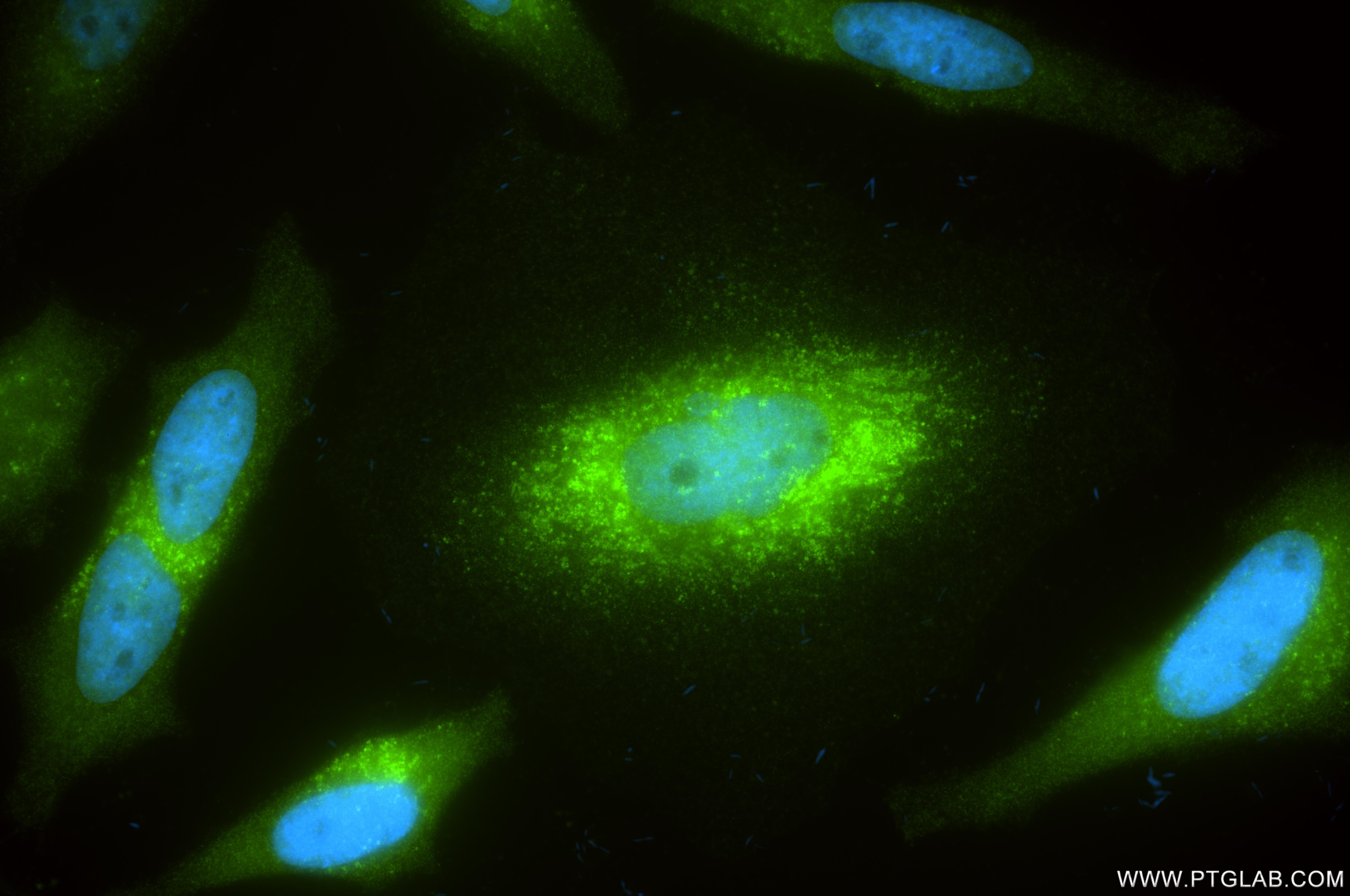 Immunofluorescent analysis of (4% PFA) fixed HeLa cells using Syntenin-1 antibody (86968-1-RR, Clone: 252107H1 ) at dilution of 1:400 and CoraLite®488-Conjugated Goat Anti-Rabbit IgG(H+L) (SA00013-2). This data was developed using the same antibody clone with 86968-1-PBS in a different storage buffer formulation. Immunofluorescence (IF) / fluorescent staining of HeLa cells using Syntenin-1 Recombinant monoclonal antibody (86968-1-RR)