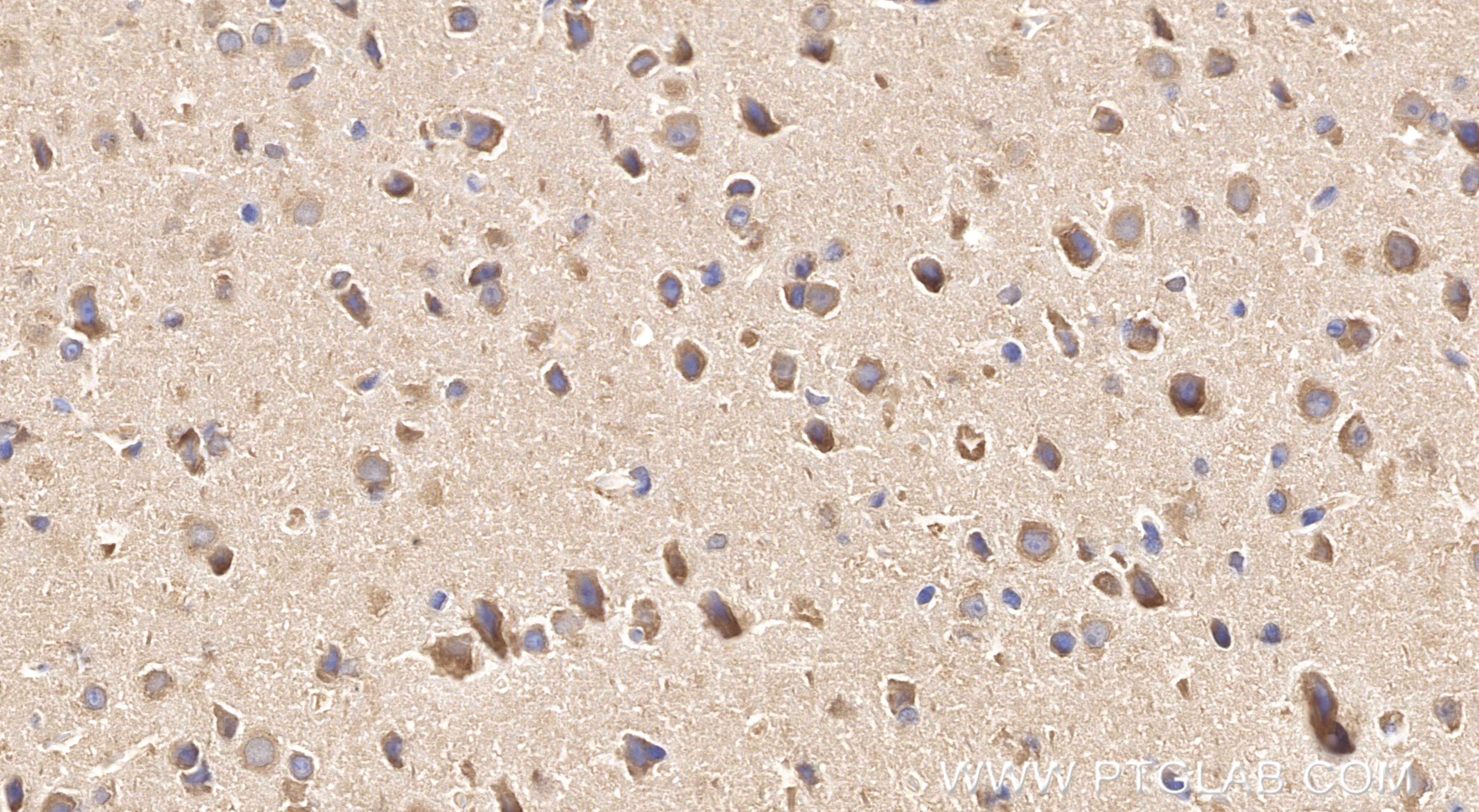 Immunohistochemical analysis of paraffin-embedded mouse brain tissue slide using 86968-1-RR (Syntenin-1 antibody) at dilution of 1:1000 (under 40x lens). Heat mediated antigen retrieval with Tris-EDTA buffer (pH 9.0). This data was developed using the same antibody clone with 86968-1-PBS in a different storage buffer formulation. Immunohistochemistry (IHC) staining of mouse brain tissue using Syntenin-1 Recombinant monoclonal antibody (86968-1-RR)