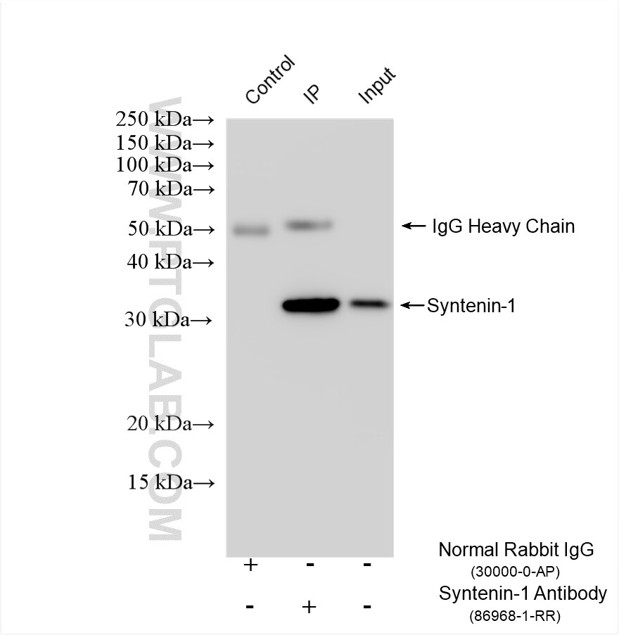 IP result of anti-Syntenin-1 (IP:86968-1-RR, 4ug; Detection:86968-1-RR 1:1000) with HeLa cells lysate 1480 ug. This data was developed using the same antibody clone with 86968-1-PBS in a different storage buffer formulation. Immunoprecipitation (IP) experiment of HeLa cells using Syntenin-1 Recombinant monoclonal antibody (86968-1-RR)