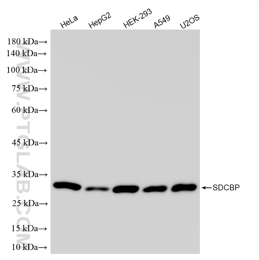 Various lysates were subjected to SDS PAGE followed by western blot with 86968-1-RR (Syntenin-1 antibody) at dilution of 1:5000 incubated at room temperature for 1.5 hours. This data was developed using the same antibody clone with 86968-1-PBS in a different storage buffer formulation. Western Blot (WB) analysis of various lysates using Syntenin-1 Recombinant monoclonal antibody (86968-1-RR)