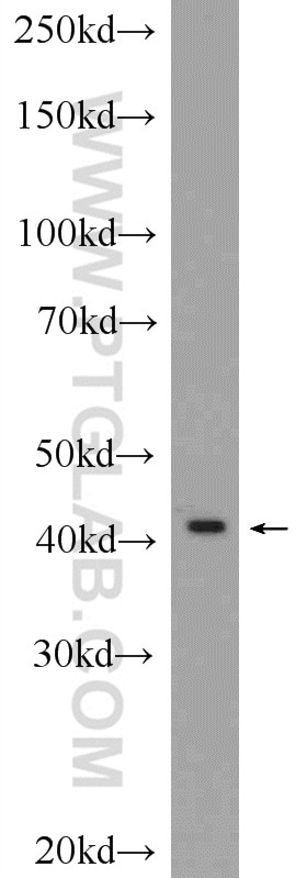 Western Blot (WB) analysis of rat brain tissue using GPR58/TAAR2 Polyclonal antibody (24609-1-AP)