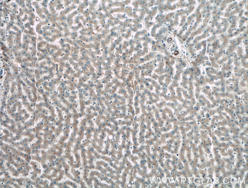 Immunohistochemistry (IHC) staining of human liver tissue using TAB1 Polyclonal antibody (27566-1-AP)