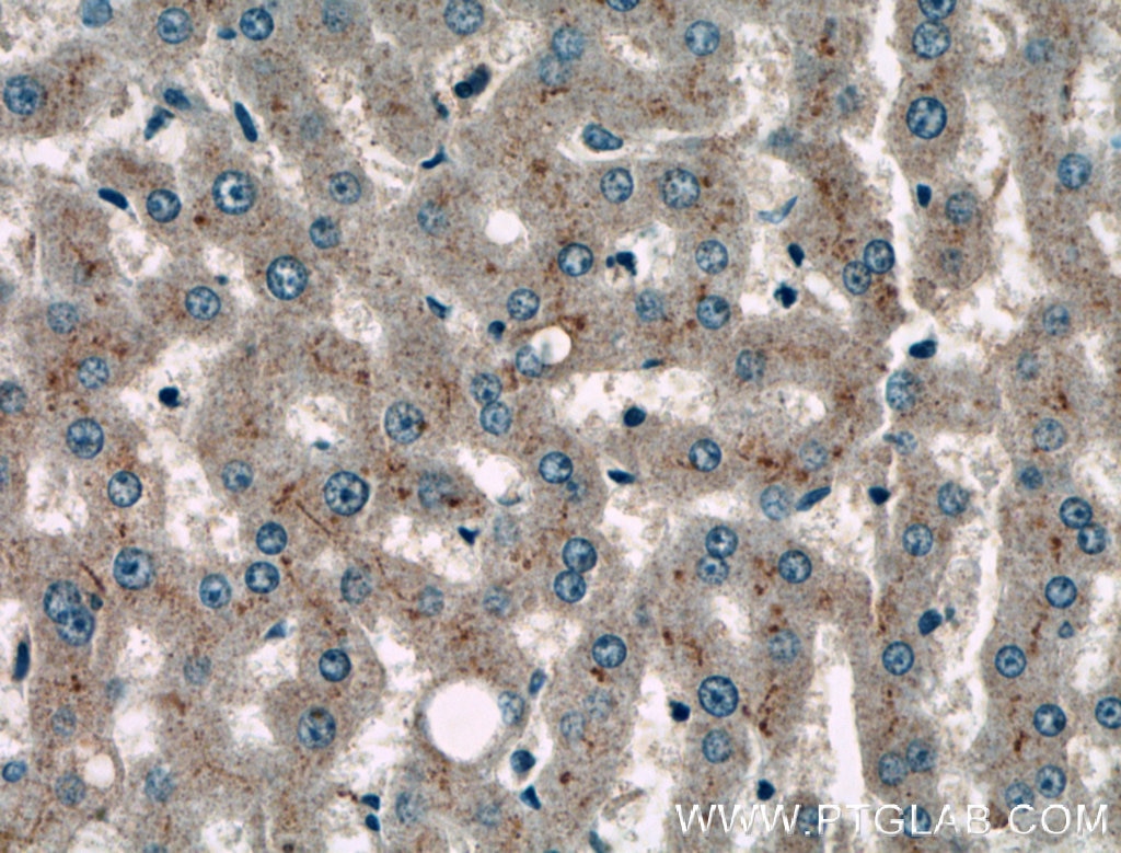 Immunohistochemistry (IHC) staining of human liver tissue using TAB1 Polyclonal antibody (27566-1-AP)