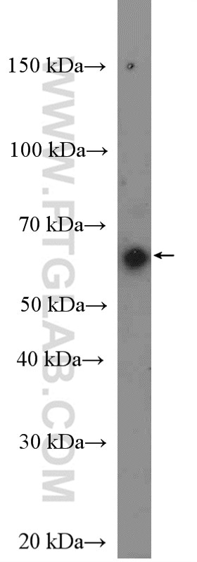 Western Blot (WB) analysis of HeLa cells using TAB1 Polyclonal antibody (27566-1-AP)