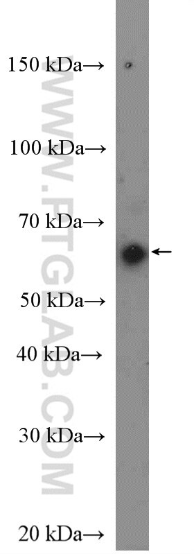 WB analysis of HeLa using 27566-1-AP