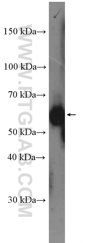 Western Blot (WB) analysis of HEK-293T cells using TAB1 Polyclonal antibody (27566-1-AP)