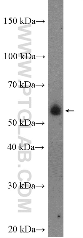 Western Blot (WB) analysis of A375 cells using TAB1 Polyclonal antibody (27566-1-AP)