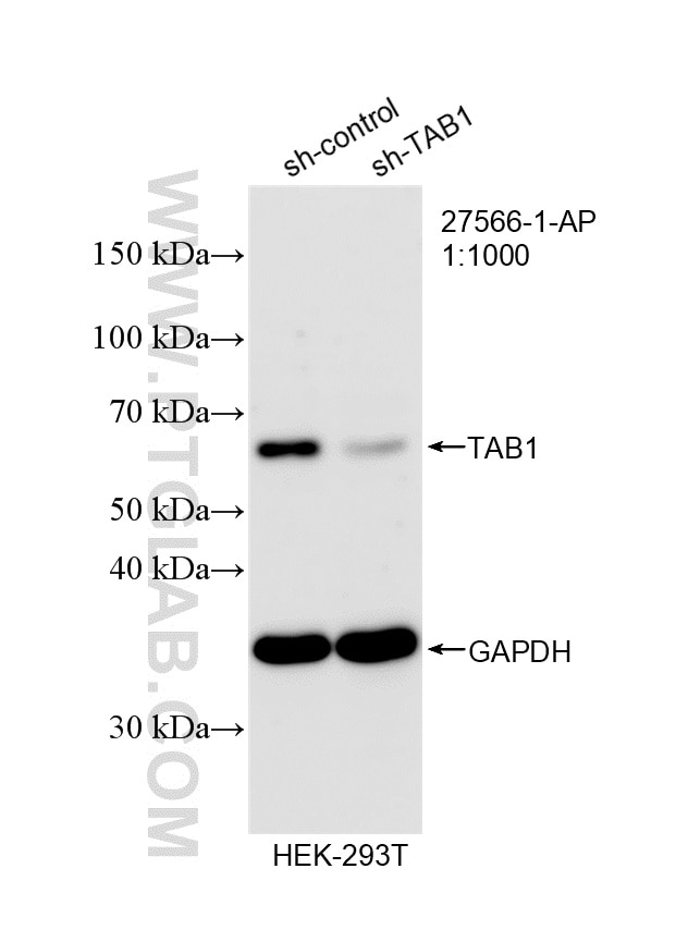 Western Blot (WB) analysis of HEK-293T cells using TAB1 Polyclonal antibody (27566-1-AP)