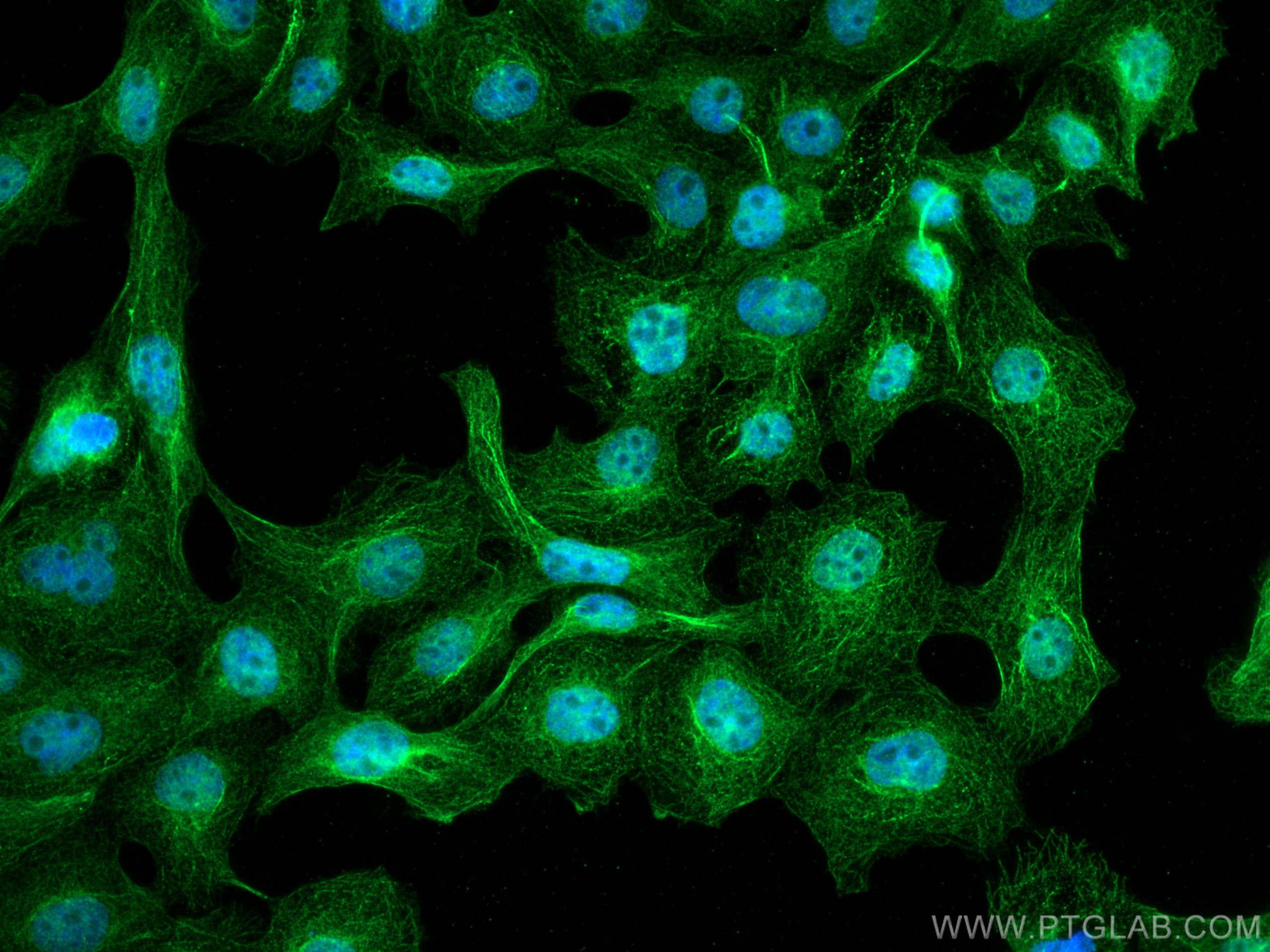 Immunofluorescence (IF) / fluorescent staining of A431 cells using TAB1 Monoclonal antibody (67020-1-Ig)