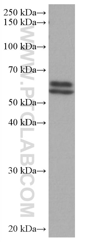 Western Blot (WB) analysis of HeLa cells using TAB1 Monoclonal antibody (67020-1-Ig)