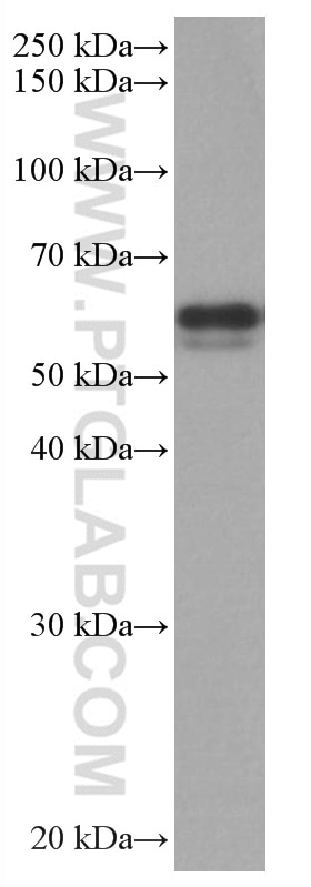 Western Blot (WB) analysis of MCF-7 cells using TAB1 Monoclonal antibody (67020-1-Ig)