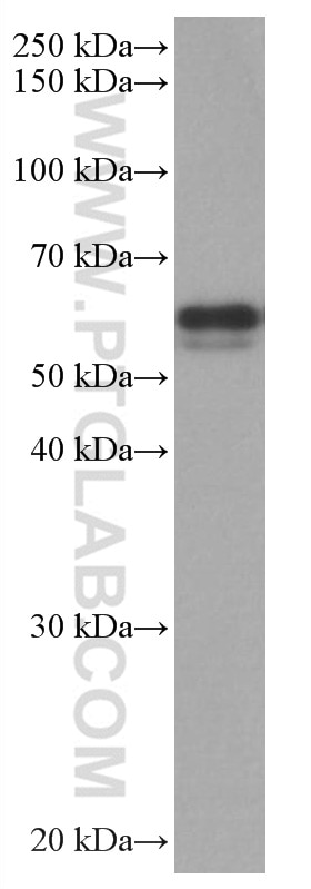 WB analysis of MCF-7 using 67020-1-Ig