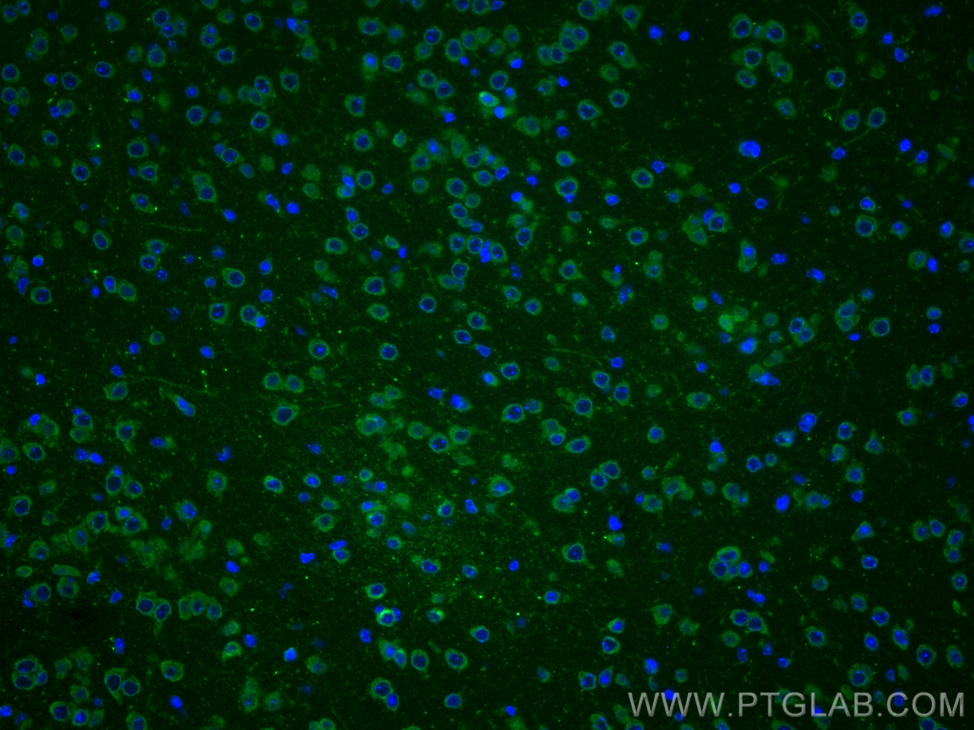 Immunofluorescence (IF) / fluorescent staining of mouse brain tissue using TAC1 Polyclonal antibody (13839-1-AP)