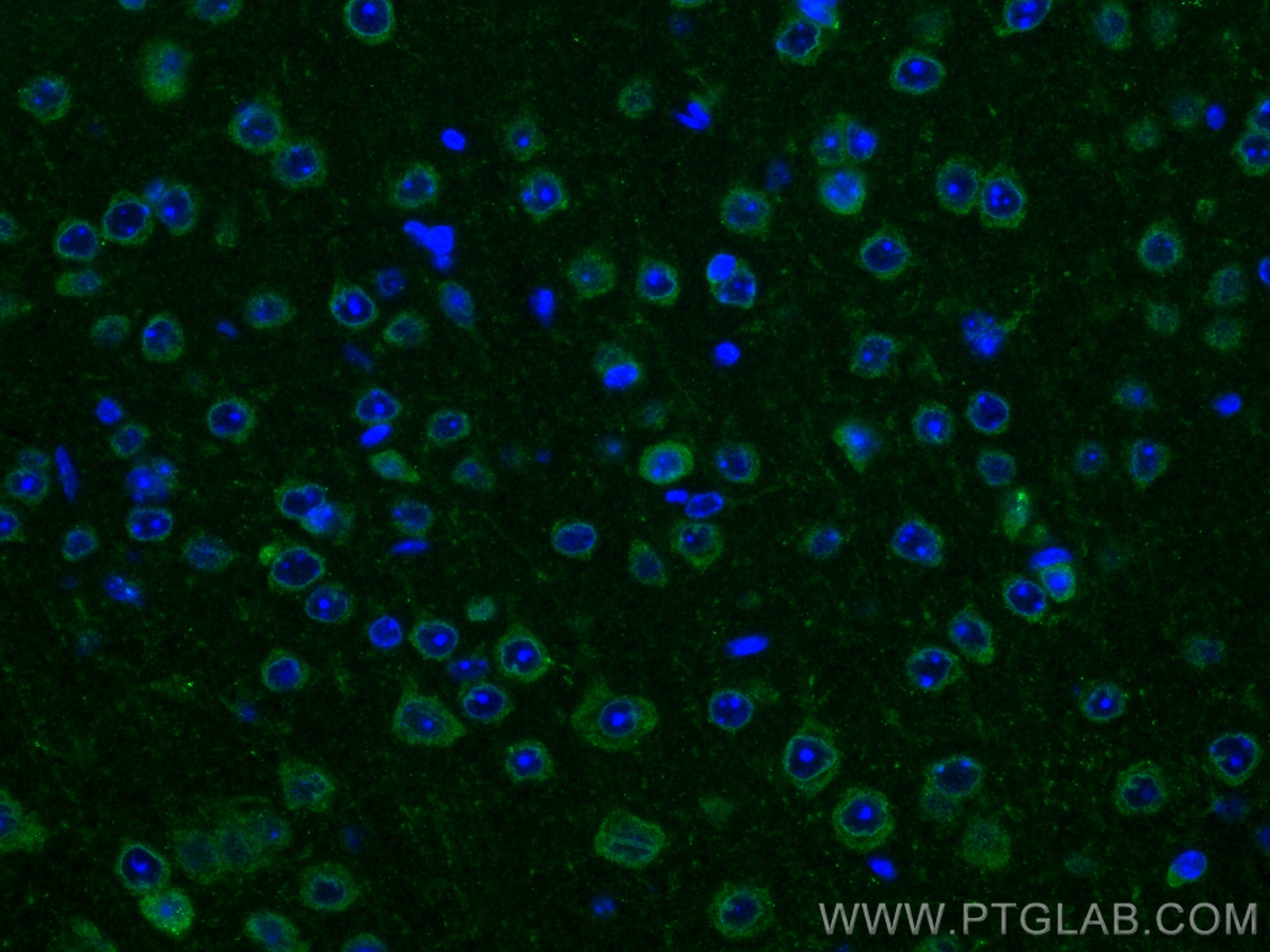 Immunofluorescence (IF) / fluorescent staining of mouse brain tissue using TAC1 Polyclonal antibody (13839-1-AP)