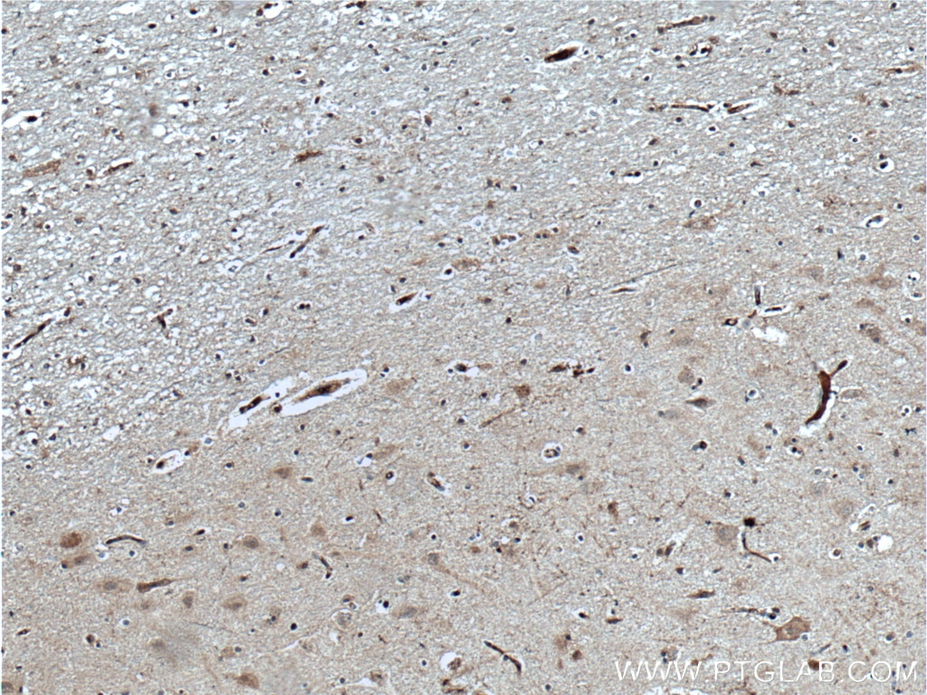 Immunohistochemistry (IHC) staining of human brain tissue using TAC1 Polyclonal antibody (13839-1-AP)