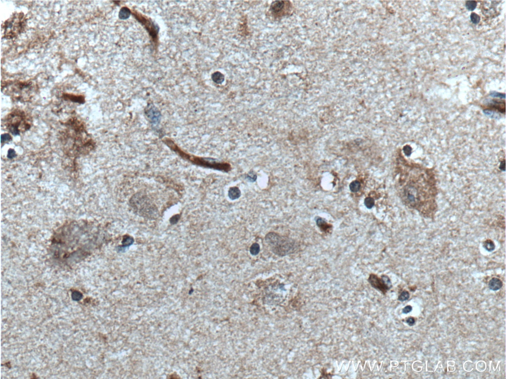 Immunohistochemistry (IHC) staining of human brain tissue using TAC1 Polyclonal antibody (13839-1-AP)