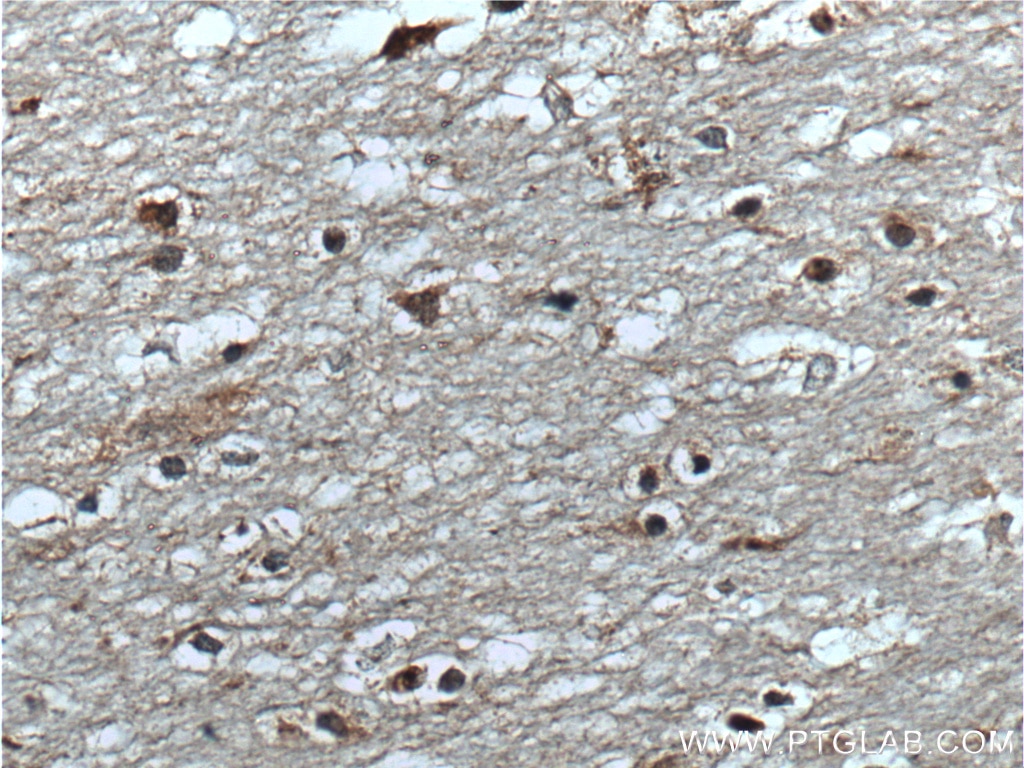 Immunohistochemistry (IHC) staining of human brain tissue using TAC1 Polyclonal antibody (13839-1-AP)