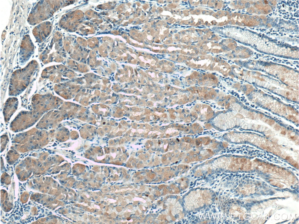 Immunohistochemistry (IHC) staining of human stomach tissue using TAC1 Polyclonal antibody (13839-1-AP)