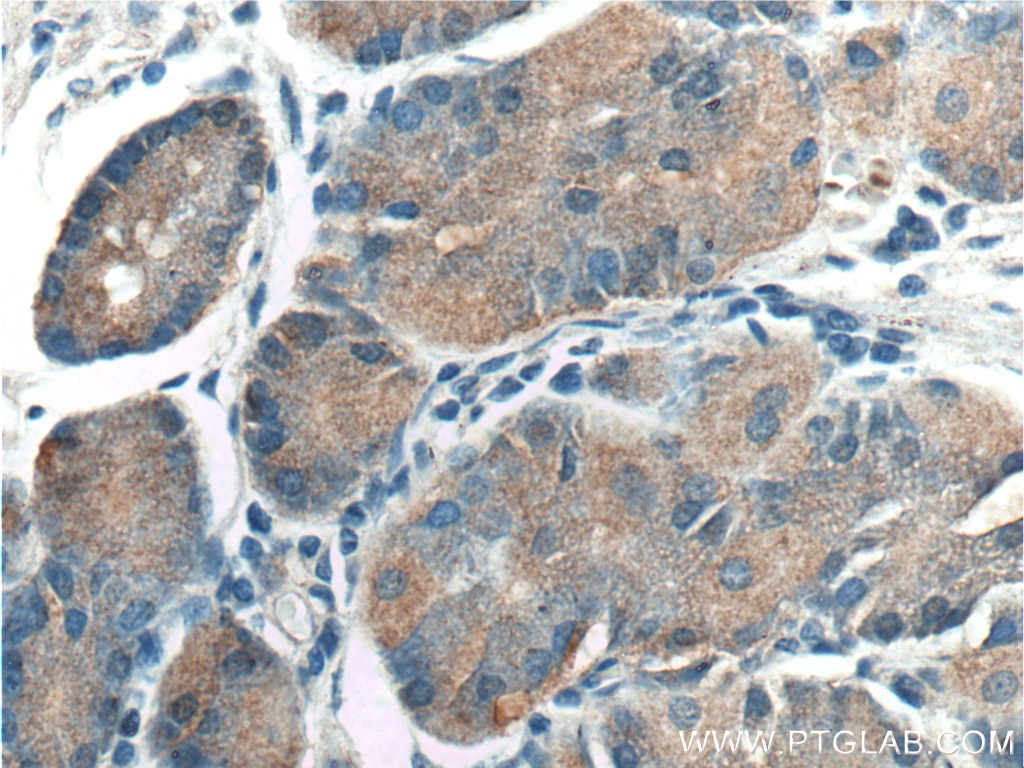 Immunohistochemistry (IHC) staining of human stomach tissue using TAC1 Polyclonal antibody (13839-1-AP)