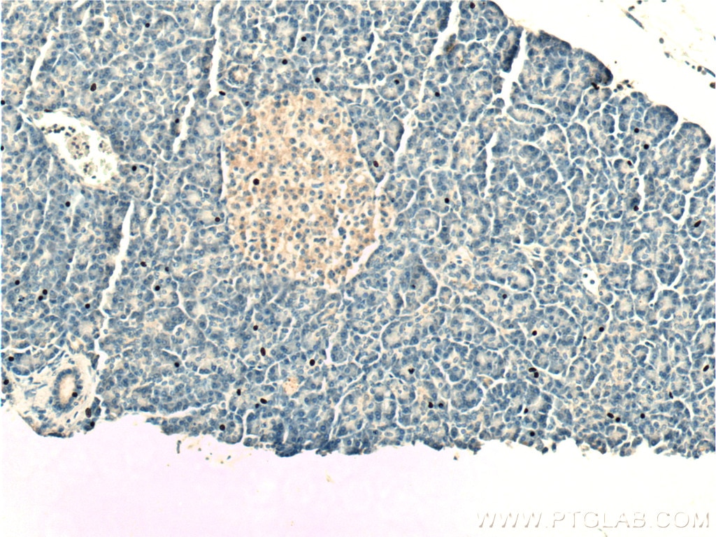 IHC staining of human pancreas using 13839-1-AP