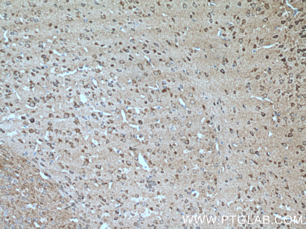 Immunohistochemistry (IHC) staining of mouse brain tissue using TAC1 Polyclonal antibody (13839-1-AP)