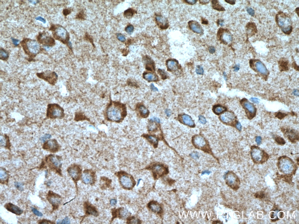 Immunohistochemistry (IHC) staining of mouse brain tissue using TAC1 Polyclonal antibody (13839-1-AP)