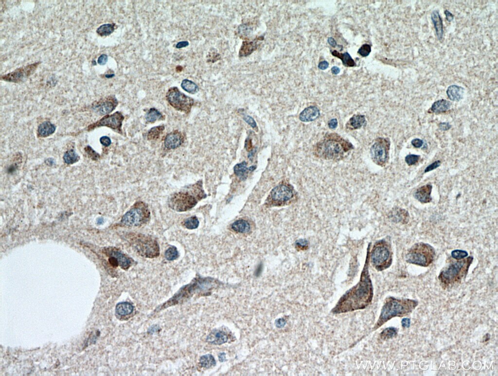 TAC1 Polyclonal antibody