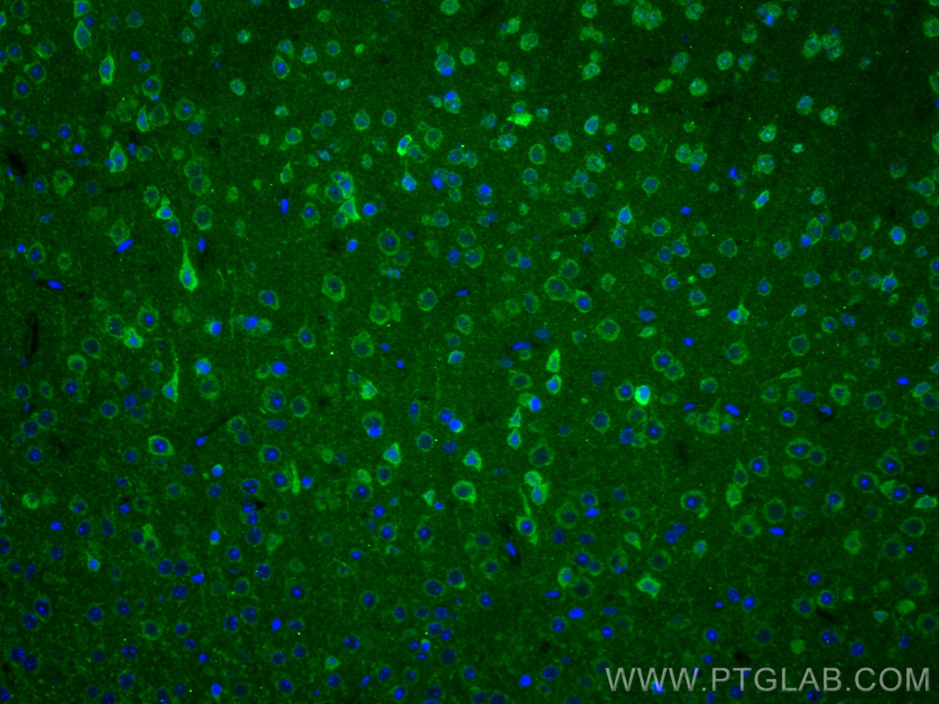 Immunofluorescence (IF) / fluorescent staining of mouse brain tissue using TAC1 Polyclonal antibody (28599-1-AP)