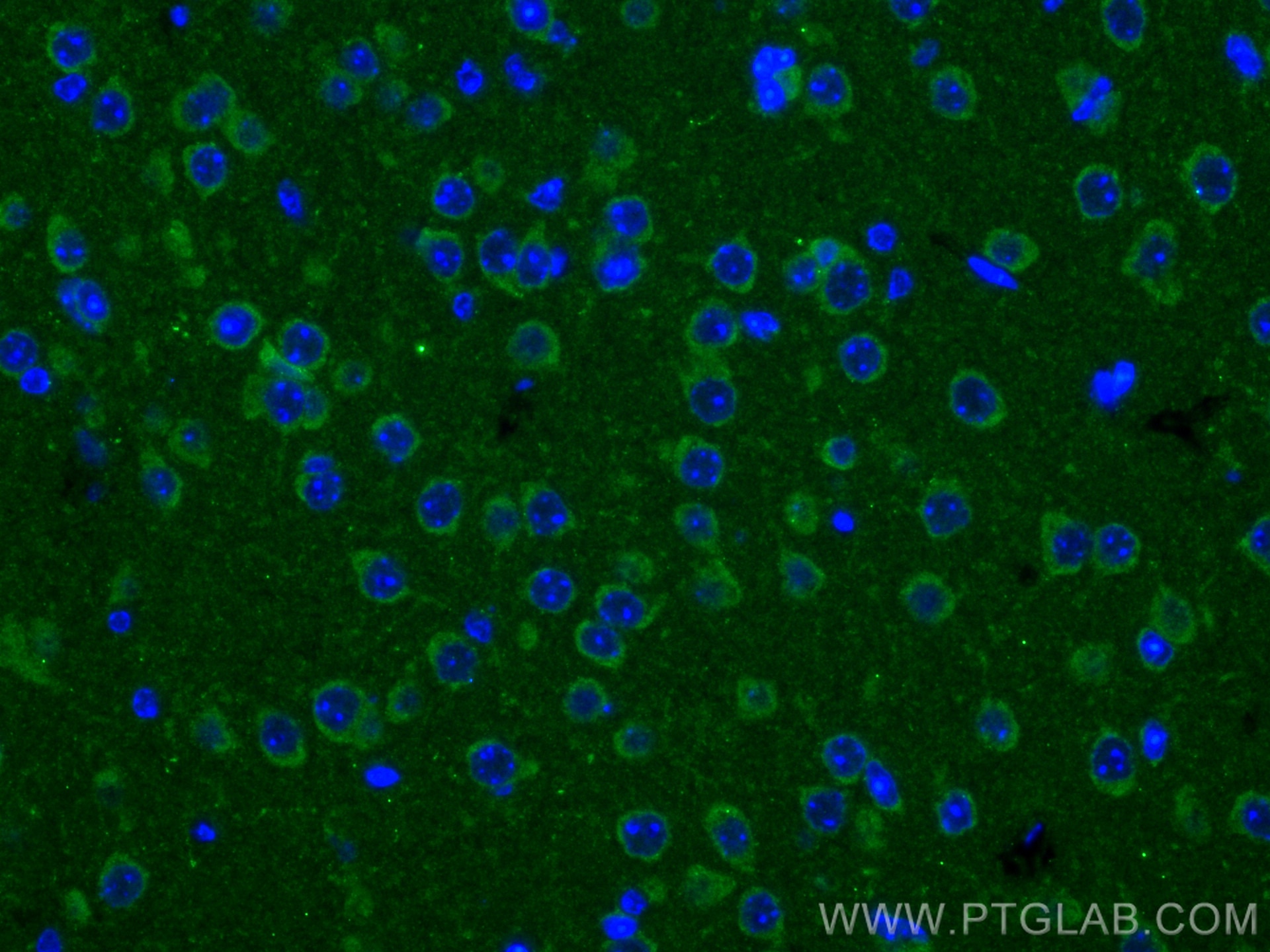 IF Staining of mouse brain using 28599-1-AP