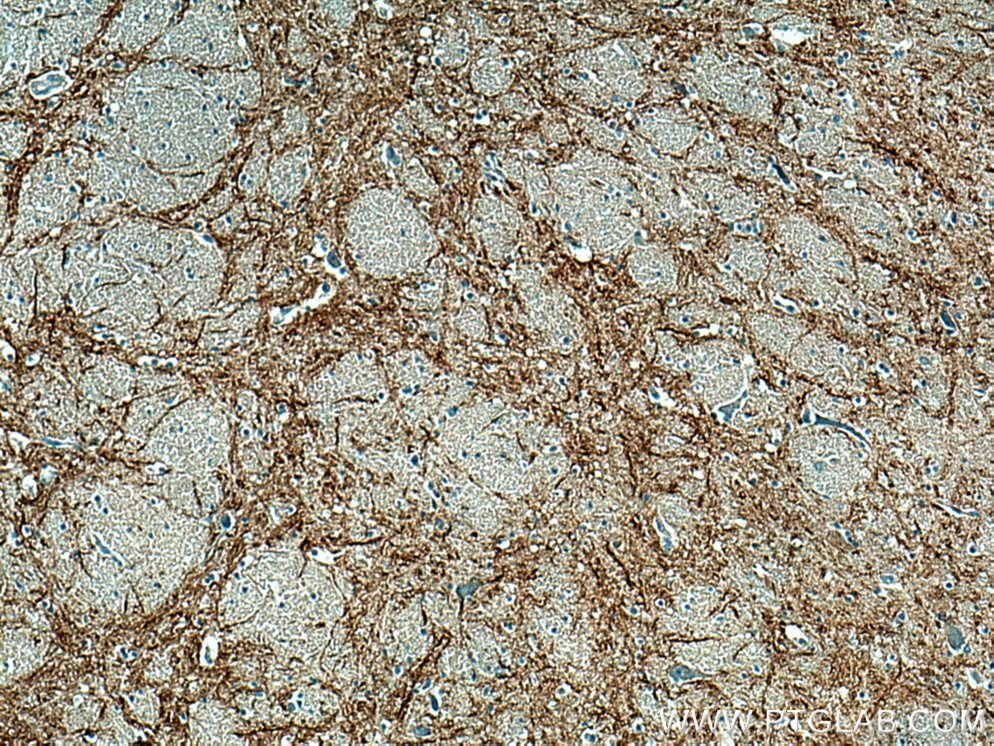 Immunohistochemistry (IHC) staining of human hypothalamus tissue using TAC1 Polyclonal antibody (28599-1-AP)