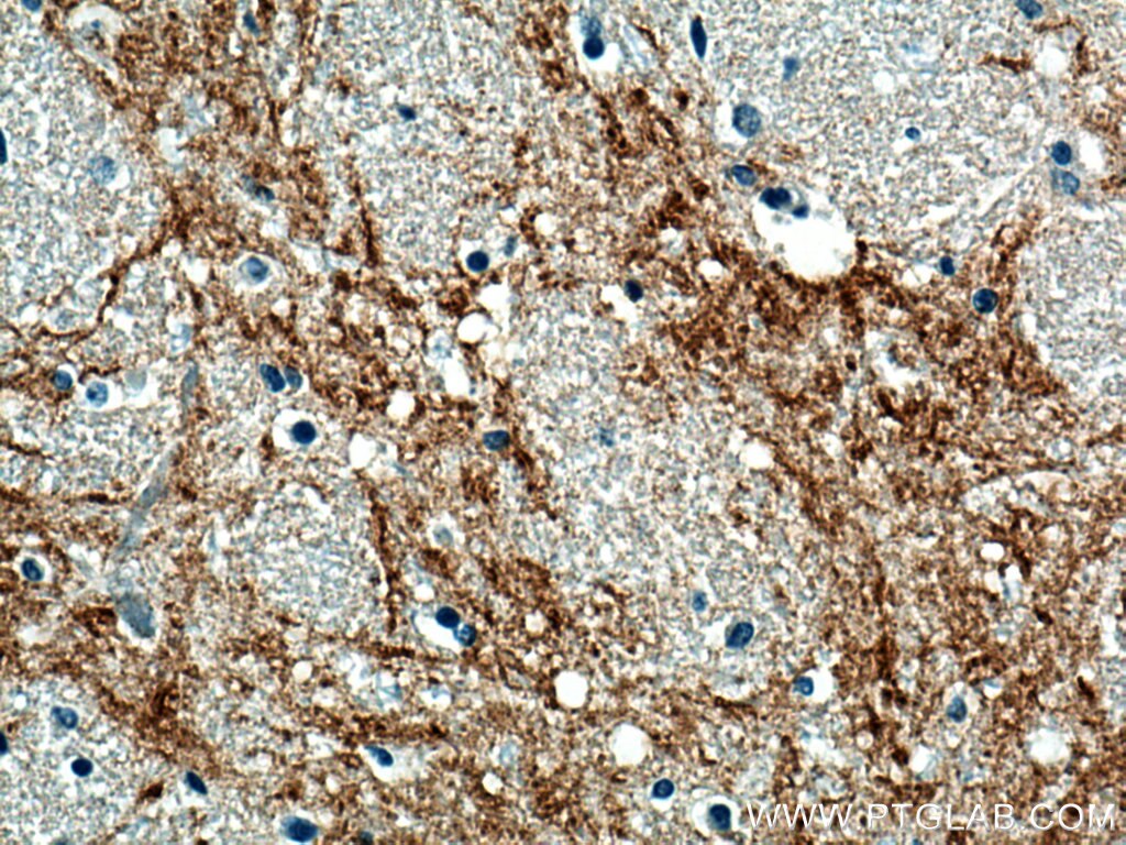 Immunohistochemistry (IHC) staining of human hypothalamus tissue using TAC1 Polyclonal antibody (28599-1-AP)