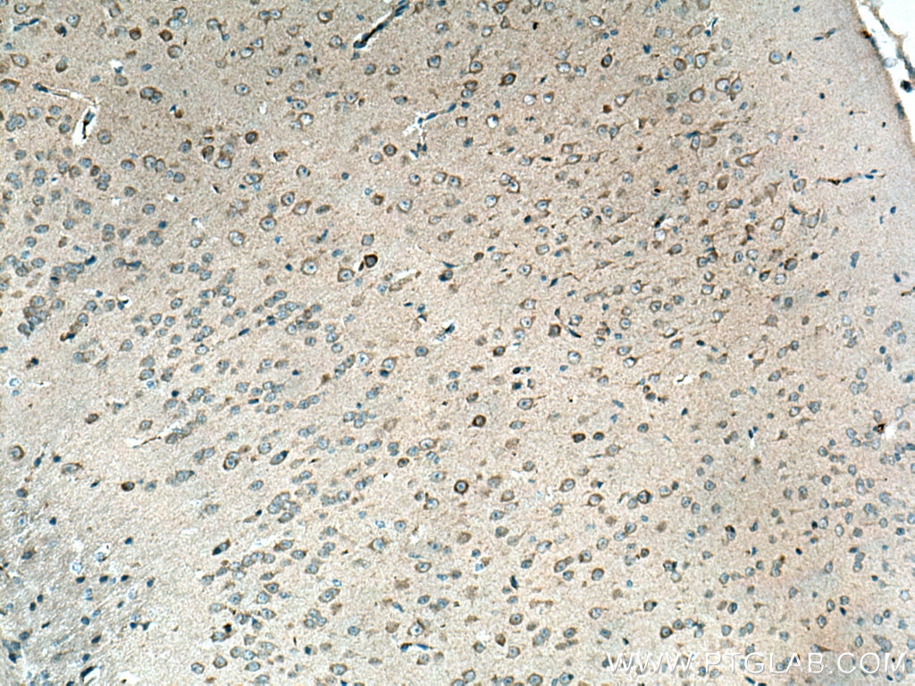 IHC staining of mouse brain using 28599-1-AP