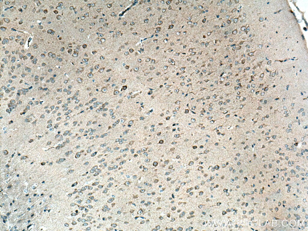 Immunohistochemistry (IHC) staining of mouse brain tissue using TAC1 Polyclonal antibody (28599-1-AP)