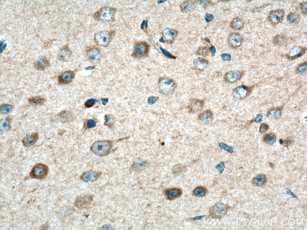 Immunohistochemistry (IHC) staining of mouse brain tissue using TAC1 Polyclonal antibody (28599-1-AP)