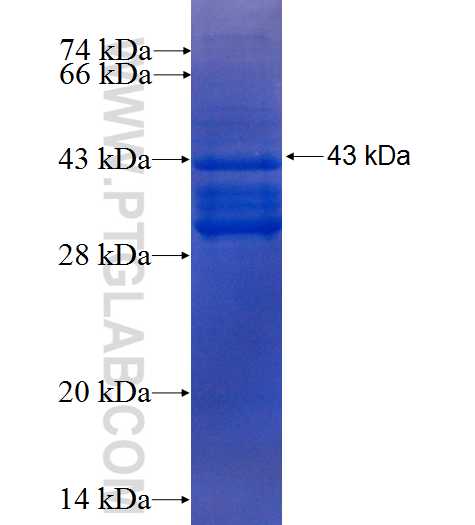 TAC1 fusion protein Ag4790 SDS-PAGE