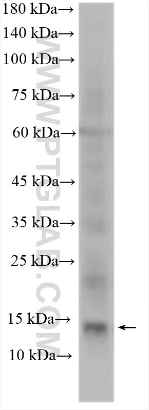 Western Blot (WB) analysis of human placenta tissue using TAC3 Polyclonal antibody (11606-1-AP)