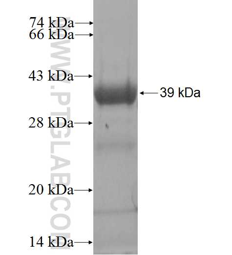 TAC3 fusion protein Ag2156 SDS-PAGE