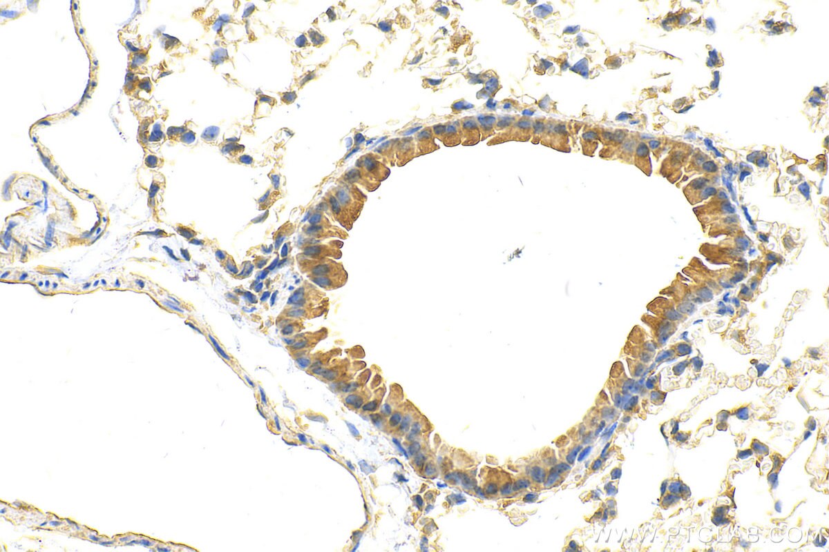 Immunohistochemistry (IHC) staining of mouse lung tissue using TAC4 Polyclonal antibody (21232-1-AP)