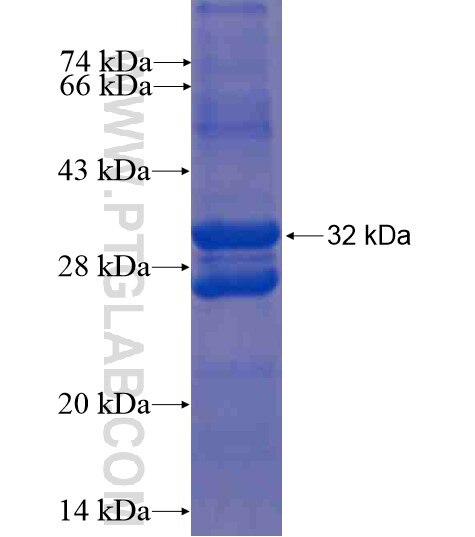 TAC4 fusion protein Ag15702 SDS-PAGE